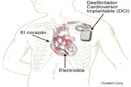 images_NOTICIAS_GENERAL_cardio